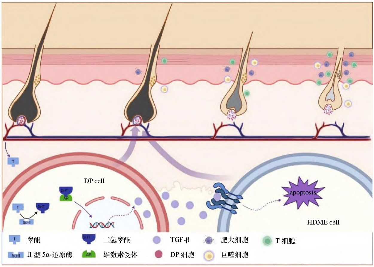 90%脱发都是因为它！雄激素性脱发研究进展与AGA动物模型介绍