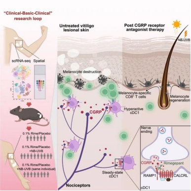 顶刊破局:《Immunity》解码白癜风神经免疫致病密码,为药物开发锚定新方向