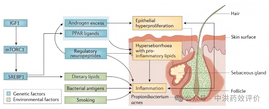 12月的痤疮新药研发赛道:四大药企各显神通,终于要和反复长痘说拜拜?